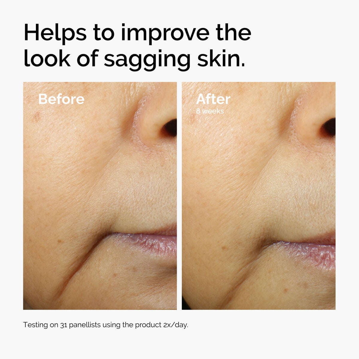 caffeine-3-escin-1-face-serum-g5 ord-caffeine-3pct-escin-1pct-face-serum-before-after-sagging.jpg
