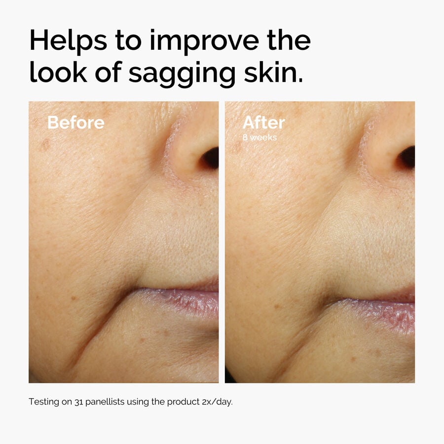 caffeine-3-escin-1-face-serum-g5 ord-caffeine-3pct-escin-1pct-face-serum-before-after-sagging.jpg