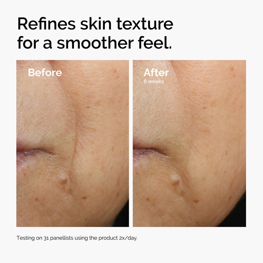caffeine-3-escin-1-face-serum-g5 ord-caffeine-3pct-escin-1pct-face-serum-before-after-texture.jpg