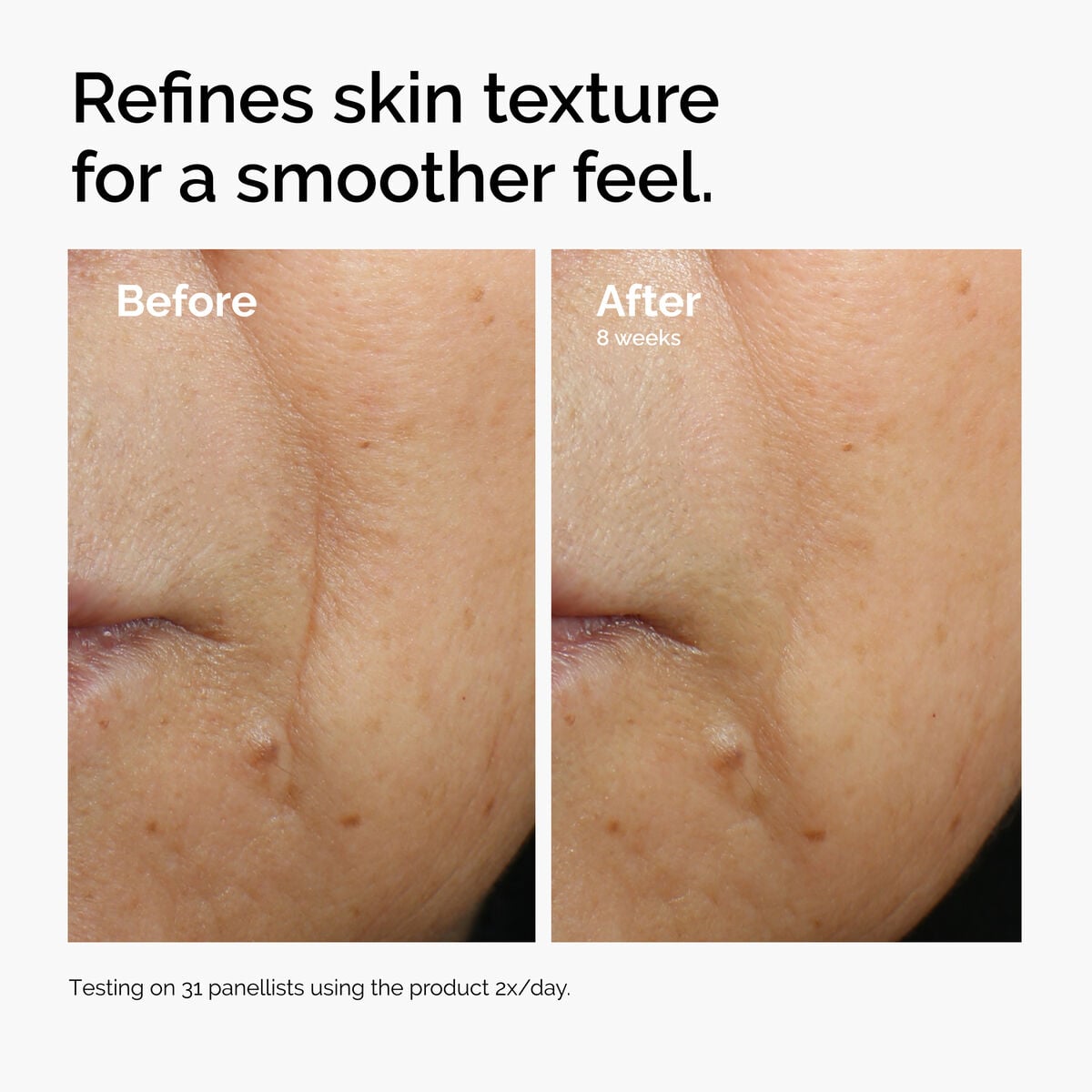caffeine-3-escin-1-face-serum-g5 ord-caffeine-3pct-escin-1pct-face-serum-before-after-texture.jpg