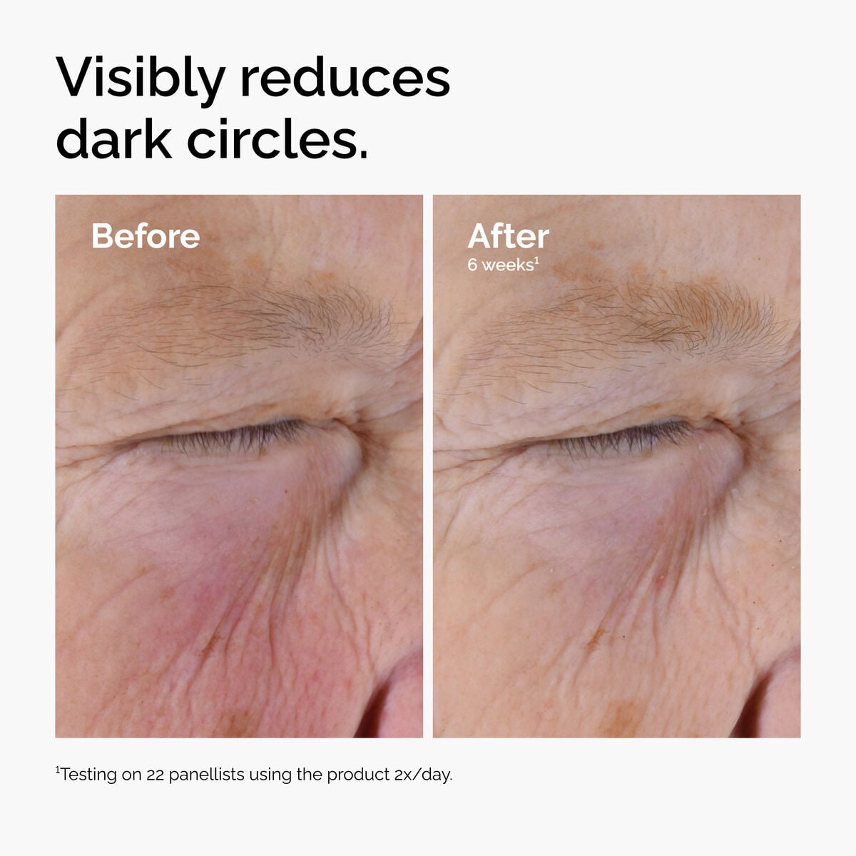 caffeine-solution-5-egcg-eye-serum-b9 ord-caffeine-solution-egcg-dark-circles-before-after.jpg
