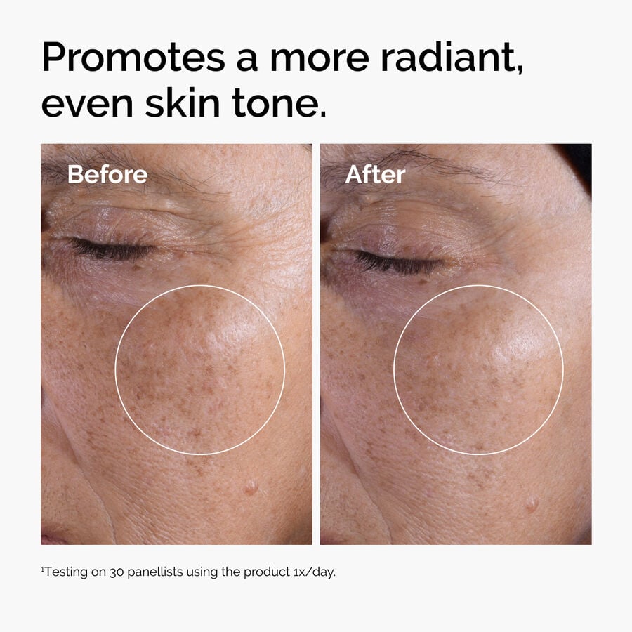glycolic-acid-7-exfoliating-toner-c0 ord-glycolic-before-after-radiance.jpg