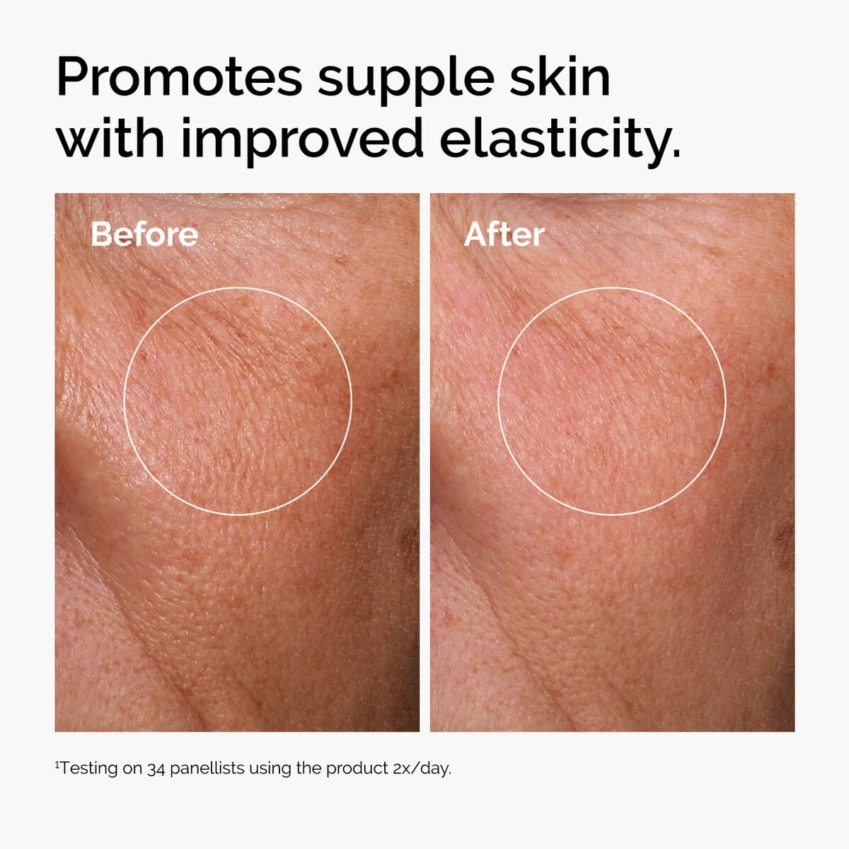 hyaluronic-acid-2-b5-with-ceramides-v8 ord-hyaluronic-acid-2pct-b5-hydrating-serum-before-after-elasticity.jpg