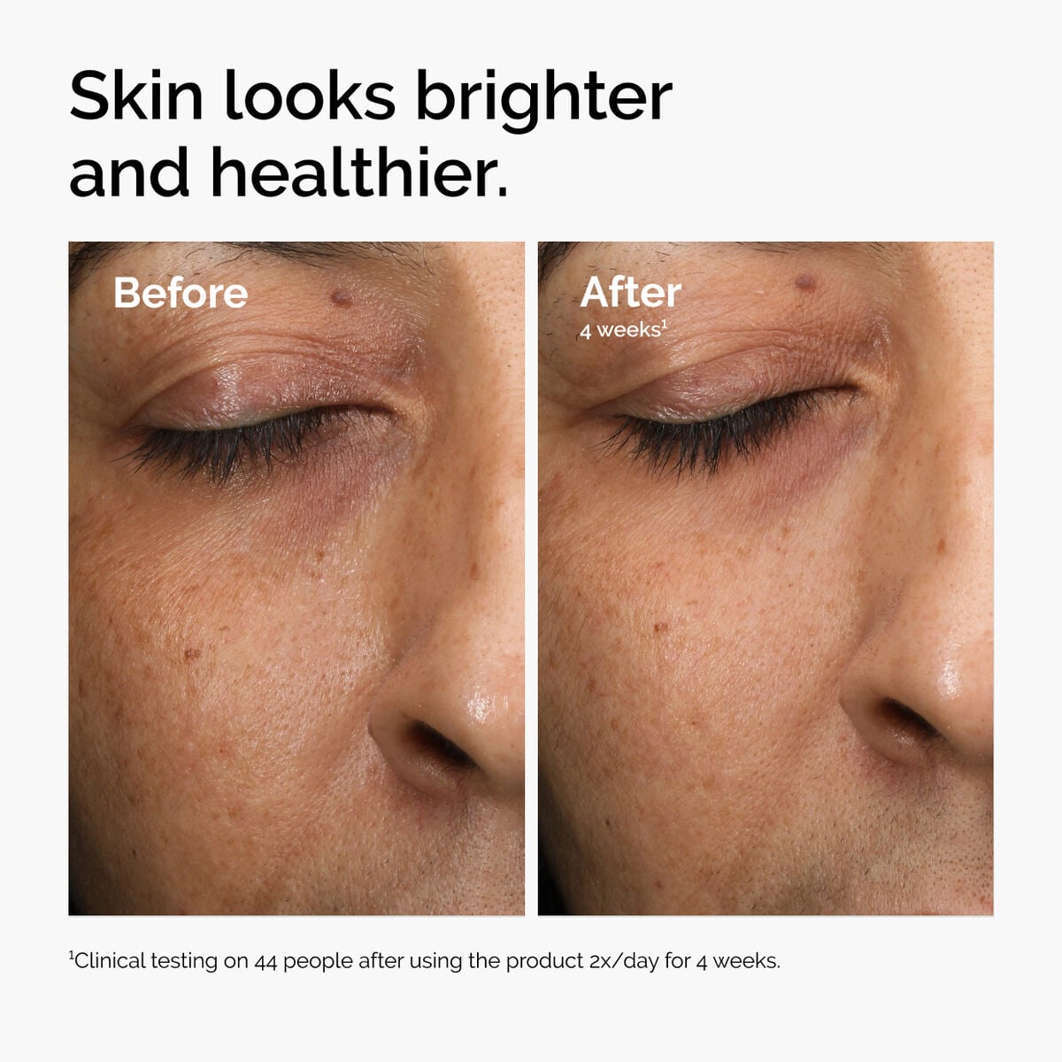 multi-antioxidant-radiance-serum-o6 ord-mars-before-after-healthy.jpg