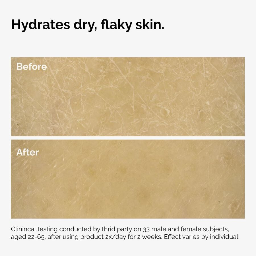 the-body-care-collection-l1 ord-natural-moisturizing-factors-inulin-body-before-after-graphic-02.jpg