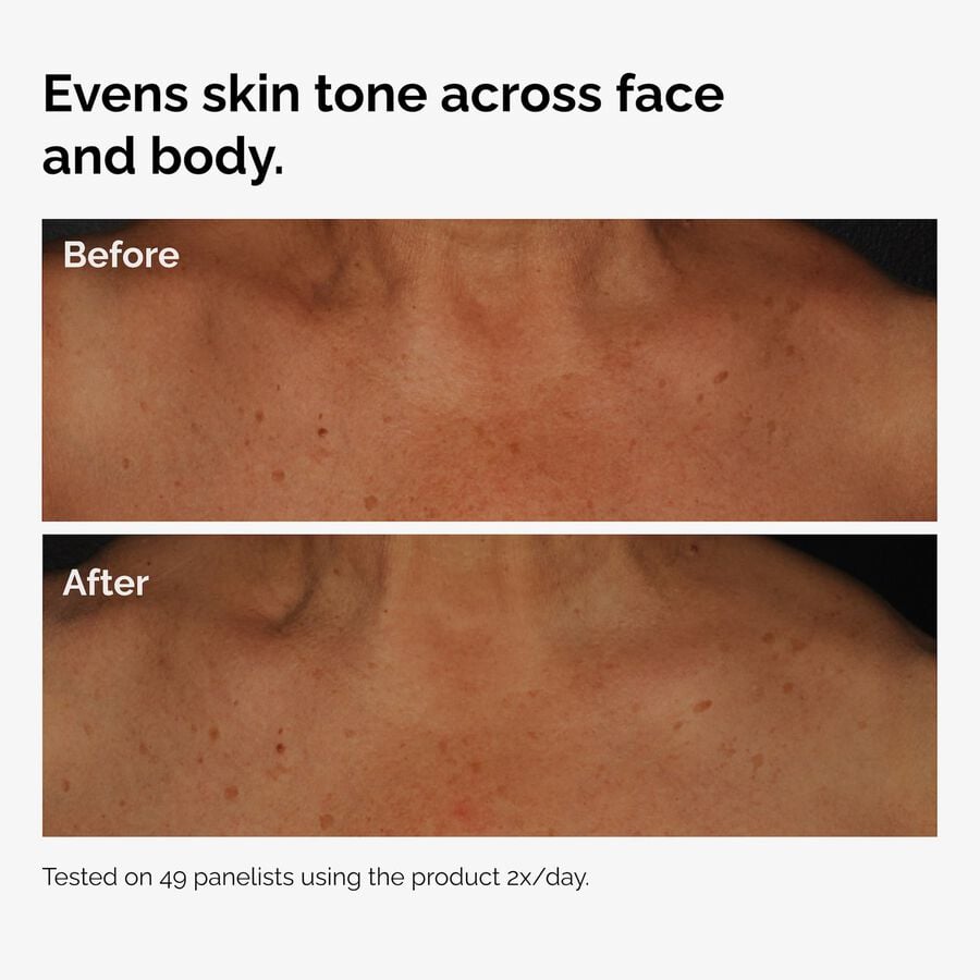 the-body-care-collection-l1 ord-niacinamide-face-body-serum-before-after-even-tone-graphic.jpg
