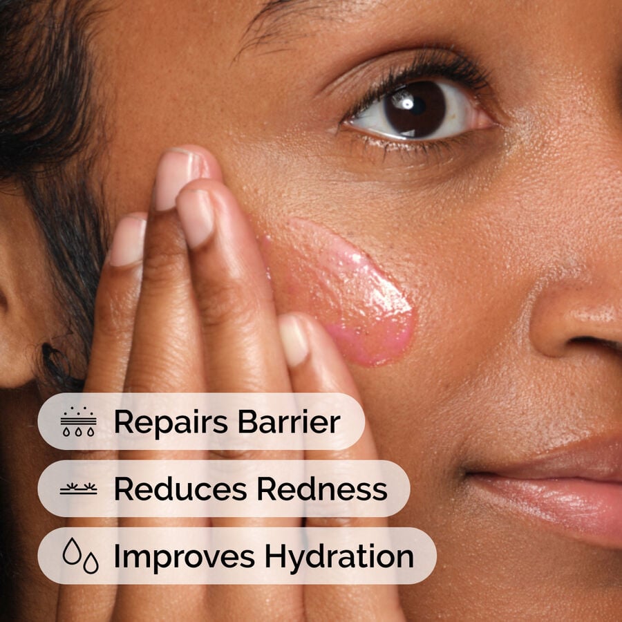 soothing-and-barrier-support-serum-u2 ord-soothing-barrier-support-serum-model-application-with-benefits.jpg